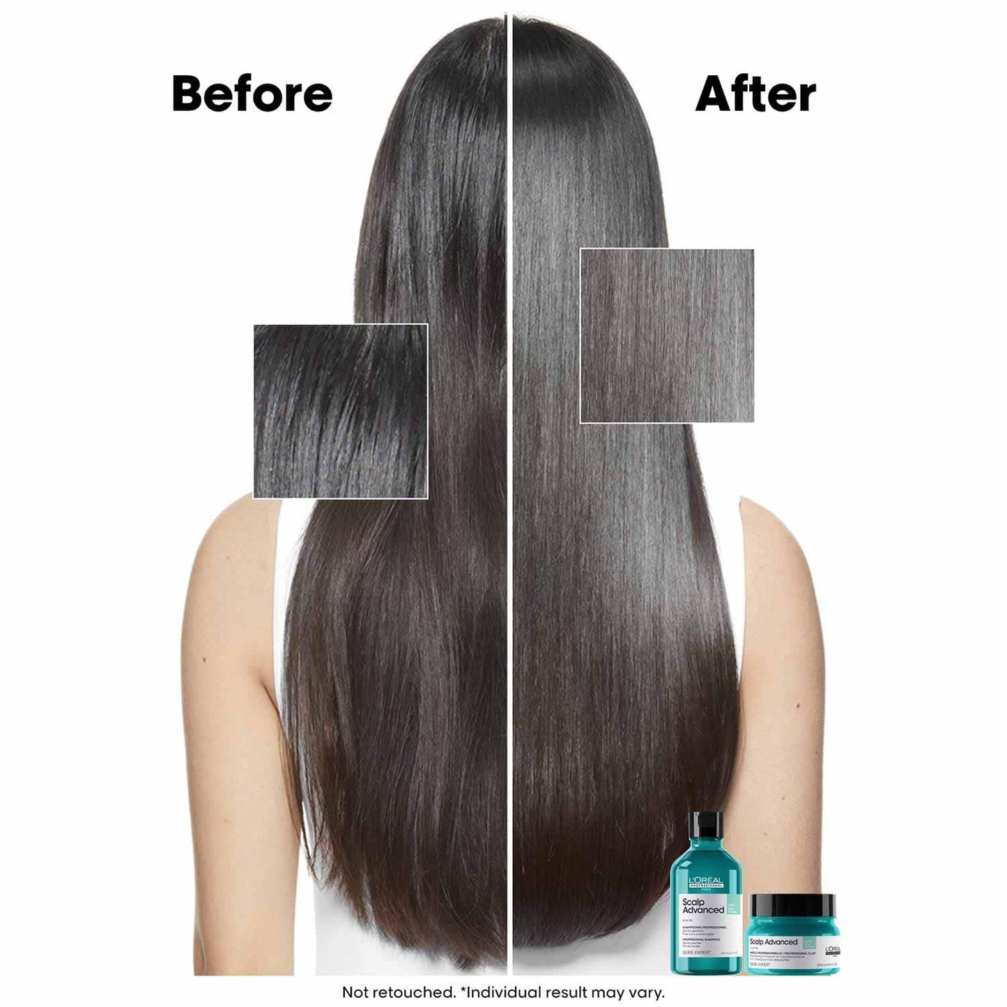 L’Oréal Professionnel Scalp Advanced Anti-Oiliness Dermo-Purifier Shampoo (300 ml) for Oily Scalps