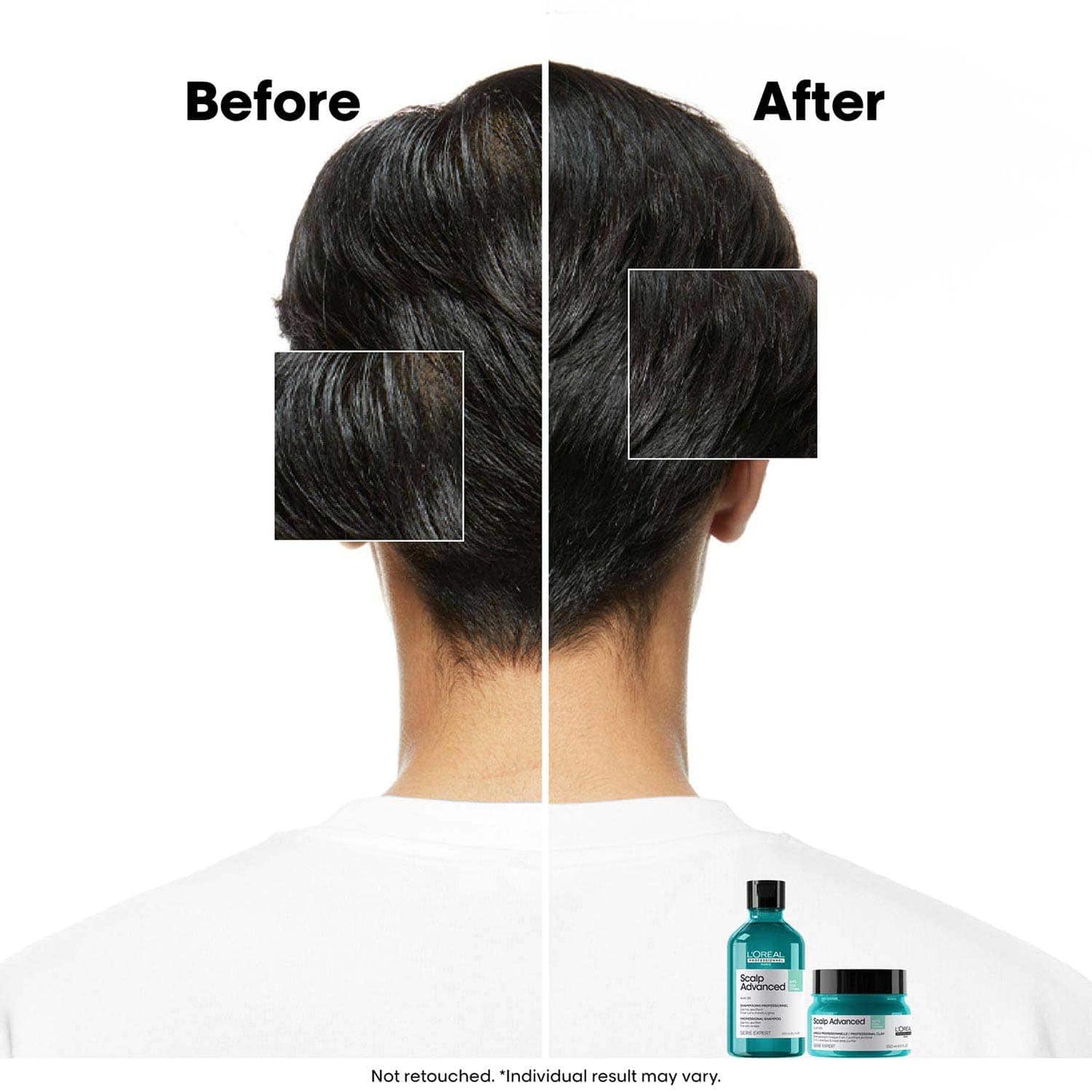 L’Oréal Professionnel Scalp Advanced Anti-Oiliness Dermo-Purifier Shampoo (300 ml) for Oily Scalps
