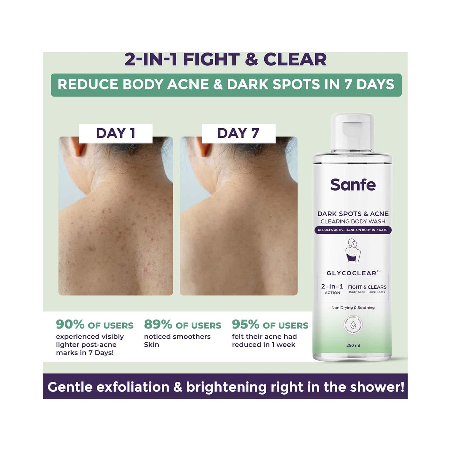 Sanfe Dark Spots and Acne Clearing Body Wash (250ml)