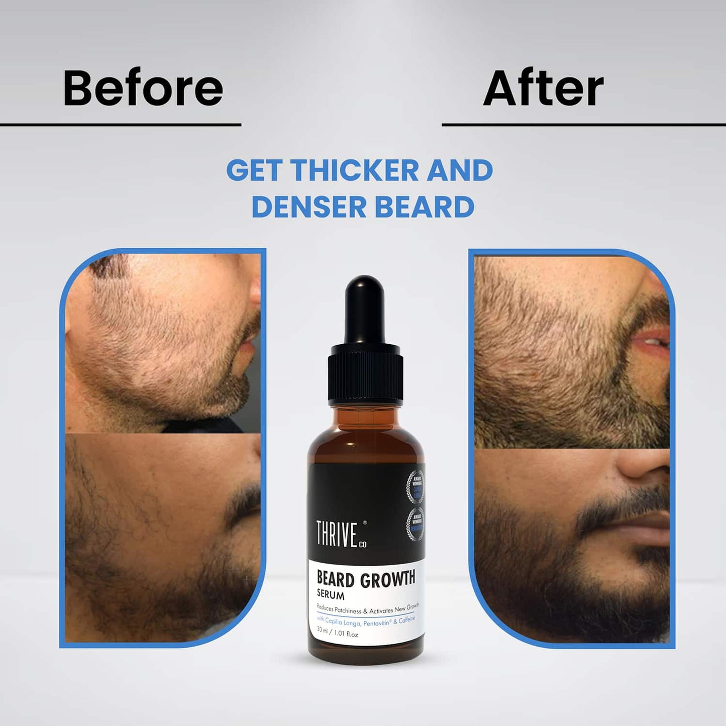 Thriveco Beard Growth Serum (30ml)